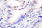 Protein Kinase C Zeta antibody, LS-C177941, Lifespan Biosciences, Immunohistochemistry frozen image 