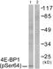 Eukaryotic Translation Initiation Factor 4E Binding Protein 1 antibody, PA5-38096, Invitrogen Antibodies, Western Blot image 