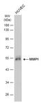 Matrix Metallopeptidase 1 antibody, GTX634537, GeneTex, Western Blot image 