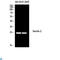 C-Type Lectin Domain Containing 6A antibody, LS-C813394, Lifespan Biosciences, Immunohistochemistry paraffin image 