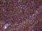 Clathrin Light Chain A antibody, M05796-1, Boster Biological Technology, Immunohistochemistry paraffin image 