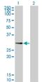 PPP1R2 Family Member B antibody, H00153743-M01, Novus Biologicals, Western Blot image 