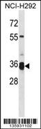 Transmembrane Serine Protease 12 antibody, 58-719, ProSci, Western Blot image 