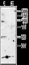 Purinergic Receptor P2X 5 antibody, GTX16812, GeneTex, Western Blot image 