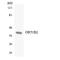 Olfactory Receptor Family 51 Subfamily B Member 2 (Gene/Pseudogene) antibody, LS-C200371, Lifespan Biosciences, Western Blot image 