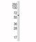 Cytochrome P450 Family 19 Subfamily A Member 1 antibody, F50283-0.4ML, NSJ Bioreagents, Western Blot image 