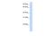 Tropomodulin-2 antibody, A12585, Boster Biological Technology, Western Blot image 