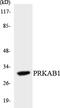 Protein Kinase AMP-Activated Non-Catalytic Subunit Beta 1 antibody, LS-C200524, Lifespan Biosciences, Western Blot image 