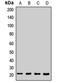 SEC11 Homolog A, Signal Peptidase Complex Subunit antibody, LS-C668312, Lifespan Biosciences, Western Blot image 