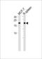 CCHC-Type Zinc Finger Nucleic Acid Binding Protein antibody, LS-C157652, Lifespan Biosciences, Western Blot image 