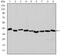 Actin Alpha 2, Smooth Muscle antibody, AM06647SU-N, Origene, Western Blot image 