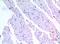 Bone Morphogenetic Protein 3 antibody, A04449-1, Boster Biological Technology, Immunohistochemistry paraffin image 