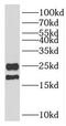 Parkinsonism Associated Deglycase antibody, FNab06148, FineTest, Western Blot image 