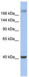 Host Cell Factor C1 antibody, TA343527, Origene, Western Blot image 