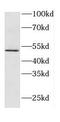 Atypical Chemokine Receptor 3 antibody, FNab02105, FineTest, Western Blot image 