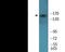 Insulin Receptor antibody, EKC2077, Boster Biological Technology, Western Blot image 