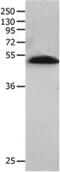 BPI Fold Containing Family B Member 2 antibody, PA5-49721, Invitrogen Antibodies, Western Blot image 