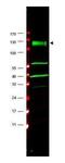 FA Complementation Group A antibody, GTX25063, GeneTex, Western Blot image 