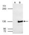 Squamous cell carcinoma antigen recognized by T-cells 3 antibody, NBP1-31487, Novus Biologicals, Immunoprecipitation image 