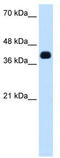 Zinc Finger And SCAN Domain Containing 16 antibody, TA345416, Origene, Western Blot image 
