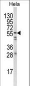 FYN Proto-Oncogene, Src Family Tyrosine Kinase antibody, LS-C166293, Lifespan Biosciences, Western Blot image 