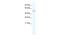 Transmembrane Protein 108 antibody, A16439, Boster Biological Technology, Western Blot image 