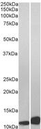 Macrophage Migration Inhibitory Factor antibody, LS-B2586, Lifespan Biosciences, Western Blot image 