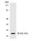 RAS Like Family 10 Member A antibody, LS-C200570, Lifespan Biosciences, Western Blot image 