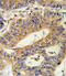 Interleukin 17 Receptor B antibody, 62-448, ProSci, Immunohistochemistry paraffin image 