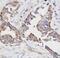 Secreted Phosphoprotein 1 antibody, PA1431, Boster Biological Technology, Immunohistochemistry paraffin image 