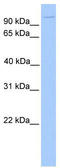 Nucleoporin 98 antibody, TA335717, Origene, Western Blot image 