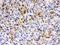 Chaperonin Containing TCP1 Subunit 5 antibody, PB9928, Boster Biological Technology, Immunohistochemistry paraffin image 