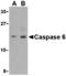 Caspase 6 antibody, A02631-1, Boster Biological Technology, Western Blot image 