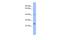 RAB5B, Member RAS Oncogene Family antibody, A06608, Boster Biological Technology, Western Blot image 