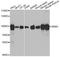 Ribonucleotide Reductase Catalytic Subunit M1 antibody, A1152, ABclonal Technology, Western Blot image 