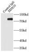 DExD-Box Helicase 50 antibody, FNab02313, FineTest, Immunoprecipitation image 