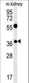 Tetraspanin 3 antibody, LS-C160265, Lifespan Biosciences, Western Blot image 