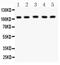 MutS Homolog 2 antibody, PA5-79695, Invitrogen Antibodies, Western Blot image 