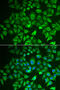 Enoyl-CoA Hydratase And 3-Hydroxyacyl CoA Dehydrogenase antibody, 15-015, ProSci, Immunofluorescence image 