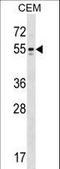 Potassium Voltage-Gated Channel Subfamily A Member 6 antibody, LS-C159967, Lifespan Biosciences, Western Blot image 