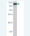 Radixin antibody, H00005962-M04, Novus Biologicals, Western Blot image 