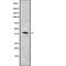 Parvin Alpha antibody, abx217646, Abbexa, Western Blot image 