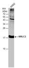 Myosin Light Chain 12B antibody, GTX102091, GeneTex, Western Blot image 