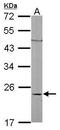 Ras Homolog Family Member C antibody, GTX100546, GeneTex, Western Blot image 