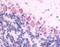 Golgi pH regulator antibody, NLS1732, Novus Biologicals, Immunohistochemistry paraffin image 