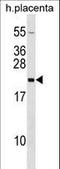 Growth Hormone 2 antibody, LS-C166467, Lifespan Biosciences, Western Blot image 