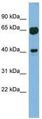 RAB3A Interacting Protein Like 1 antibody, TA345119, Origene, Western Blot image 