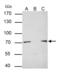 Protein Arginine Methyltransferase 5 antibody, GTX628488, GeneTex, Immunoprecipitation image 