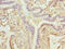 Zinc Finger Protein 212 antibody, CSB-PA026582LA01HU, Cusabio, Immunohistochemistry paraffin image 