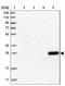 L-xylulose reductase antibody, NBP1-85279, Novus Biologicals, Western Blot image 